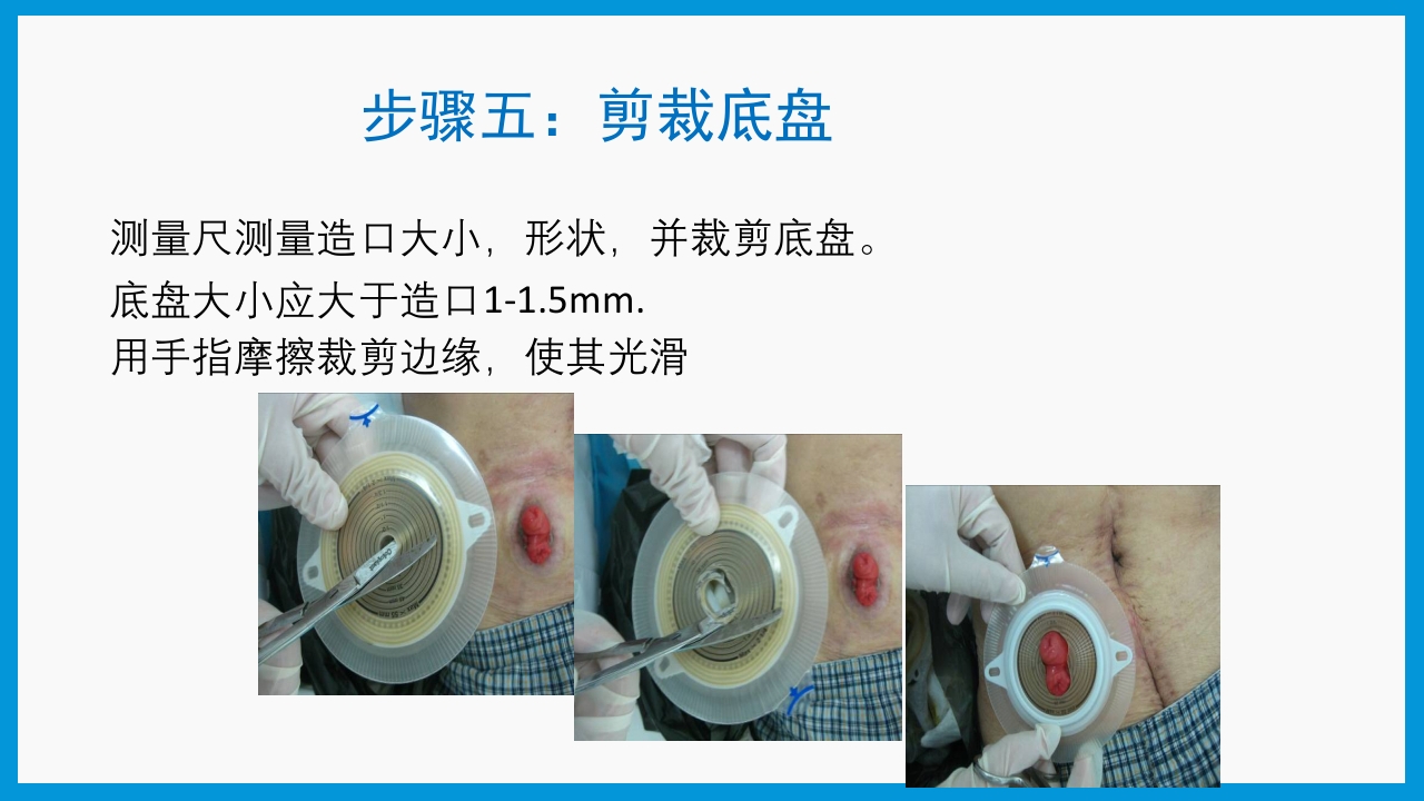 造口护理健康宣教PPT课件13