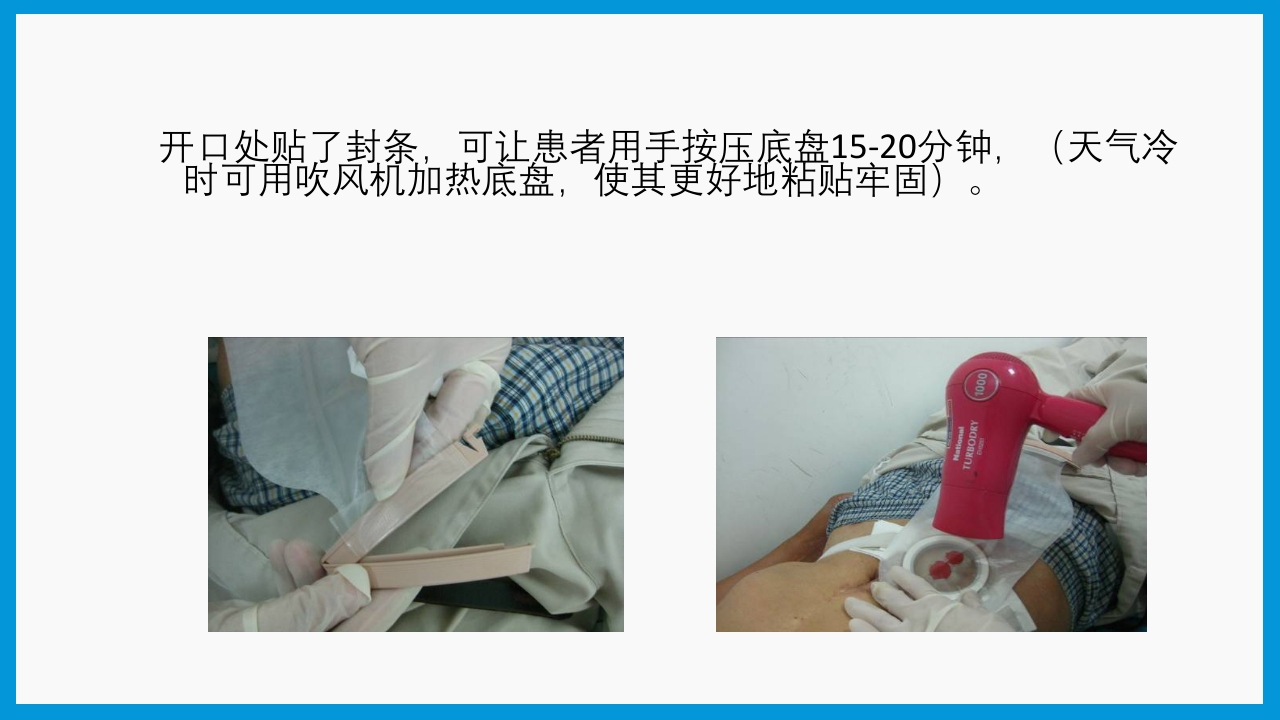 造口护理健康宣教PPT课件18