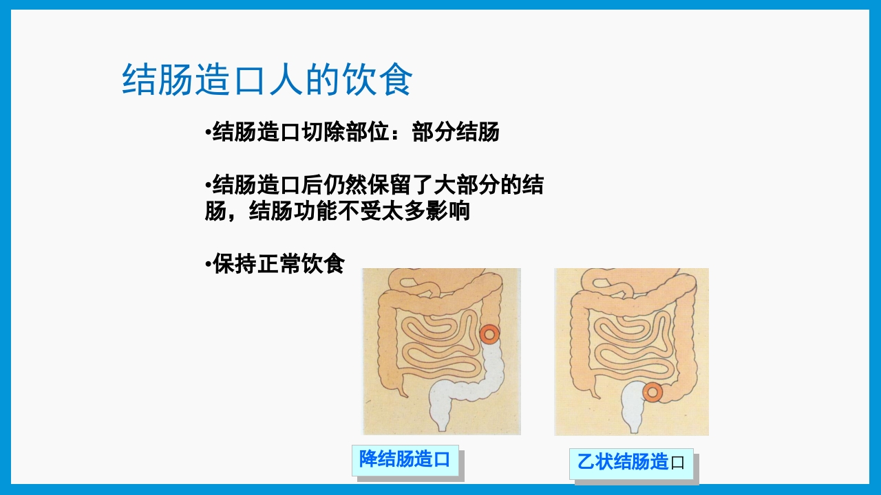 造口护理健康宣教PPT课件27