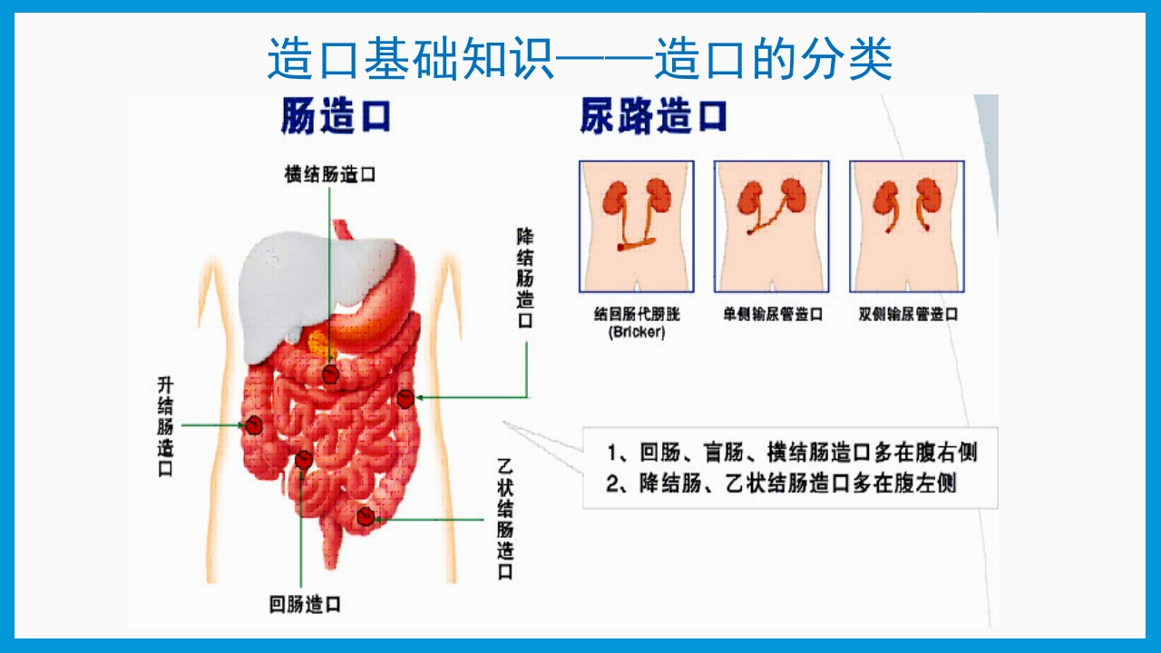 造口护理健康宣教PPT课件5