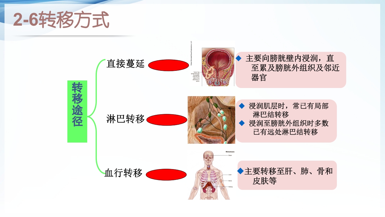 膀胱全切+回肠膀胱造口围手术期的护理查房ppt12