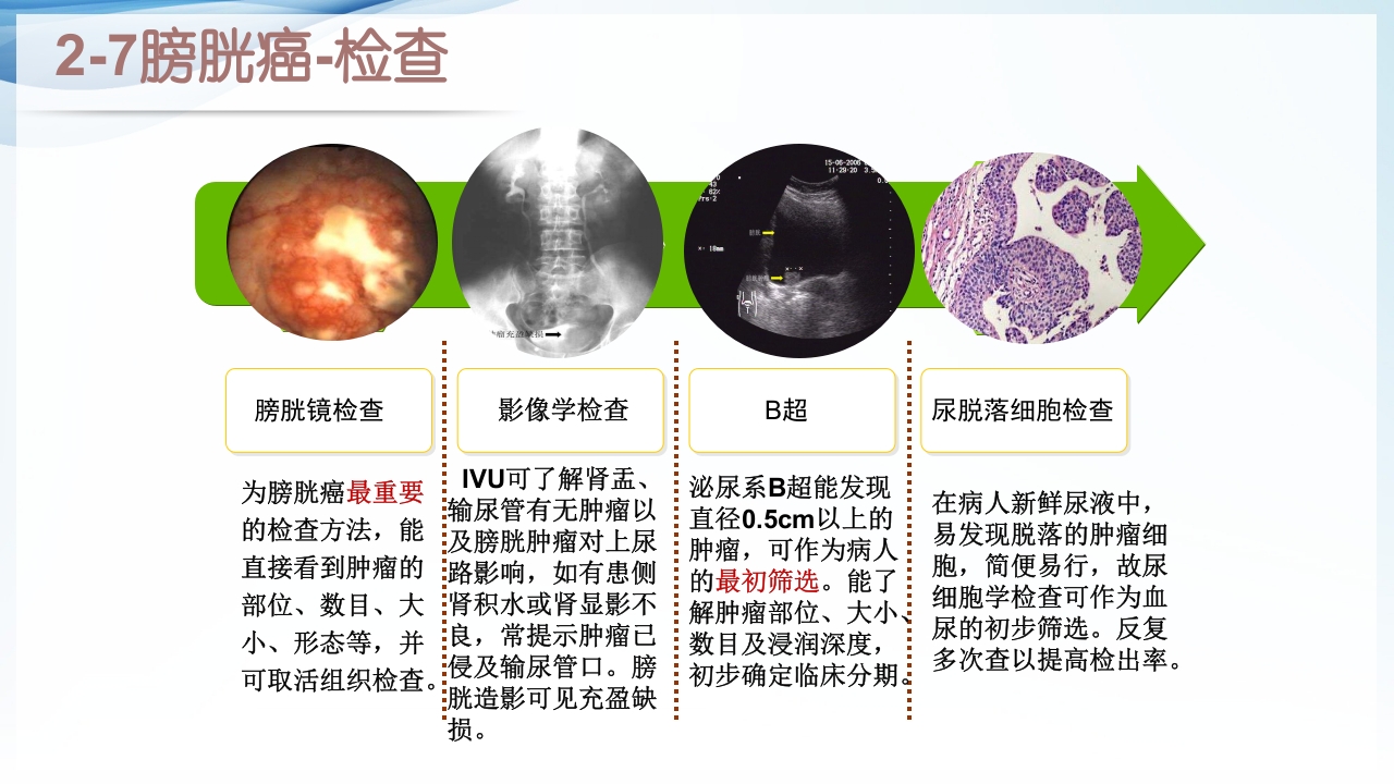 膀胱全切+回肠膀胱造口围手术期的护理查房ppt13