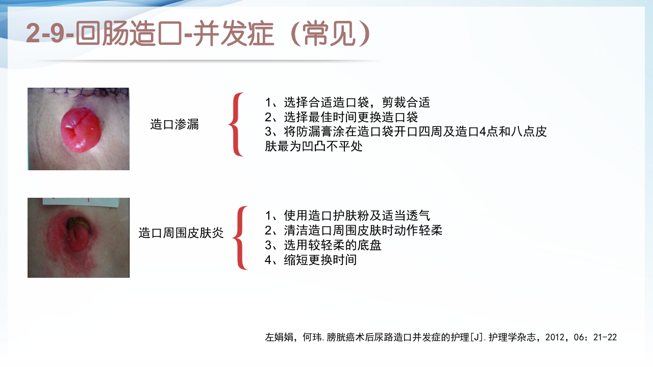 膀胱全切+回肠膀胱造口围手术期的护理查房ppt19