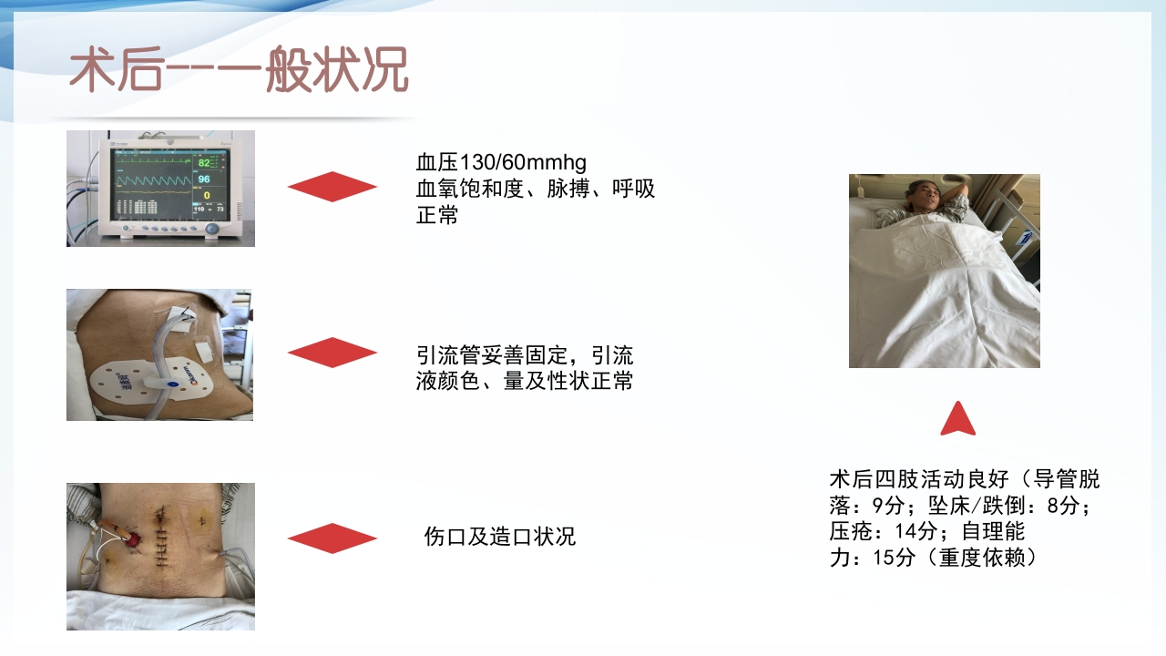 膀胱全切+回肠膀胱造口围手术期的护理查房ppt36