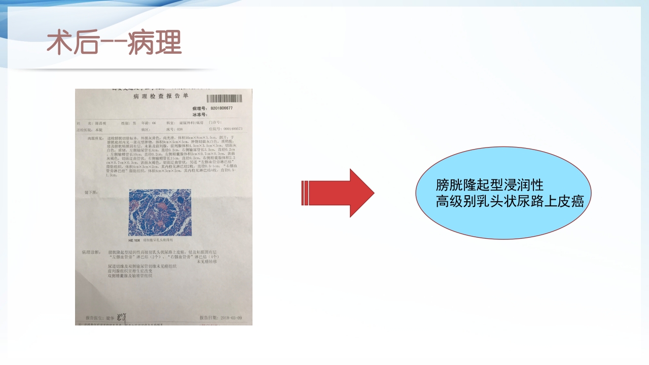 膀胱全切+回肠膀胱造口围手术期的护理查房ppt40