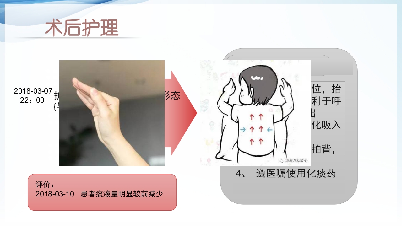 膀胱全切+回肠膀胱造口围手术期的护理查房ppt47