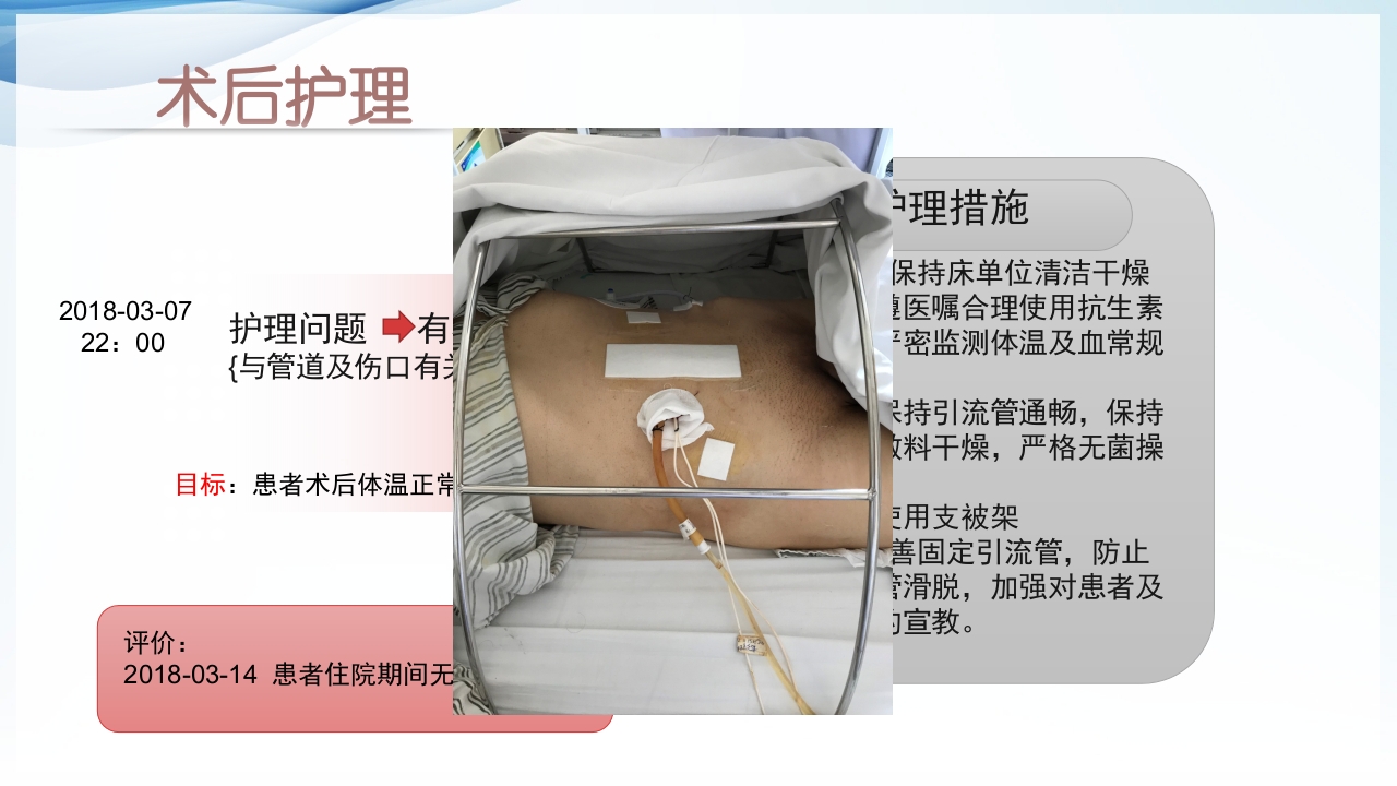 膀胱全切+回肠膀胱造口围手术期的护理查房ppt49