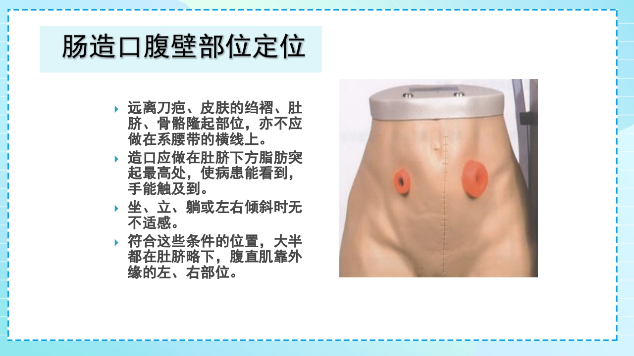 肠造口护理PPT课件11