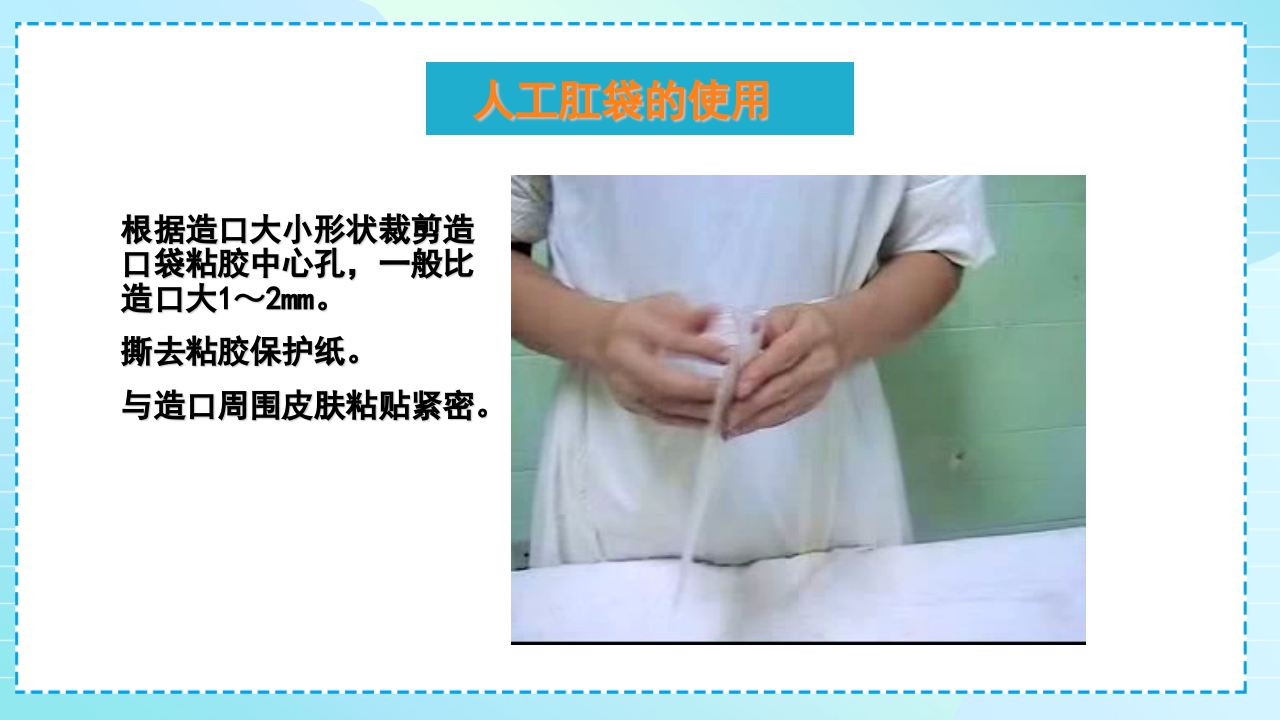 肠造口护理PPT课件14