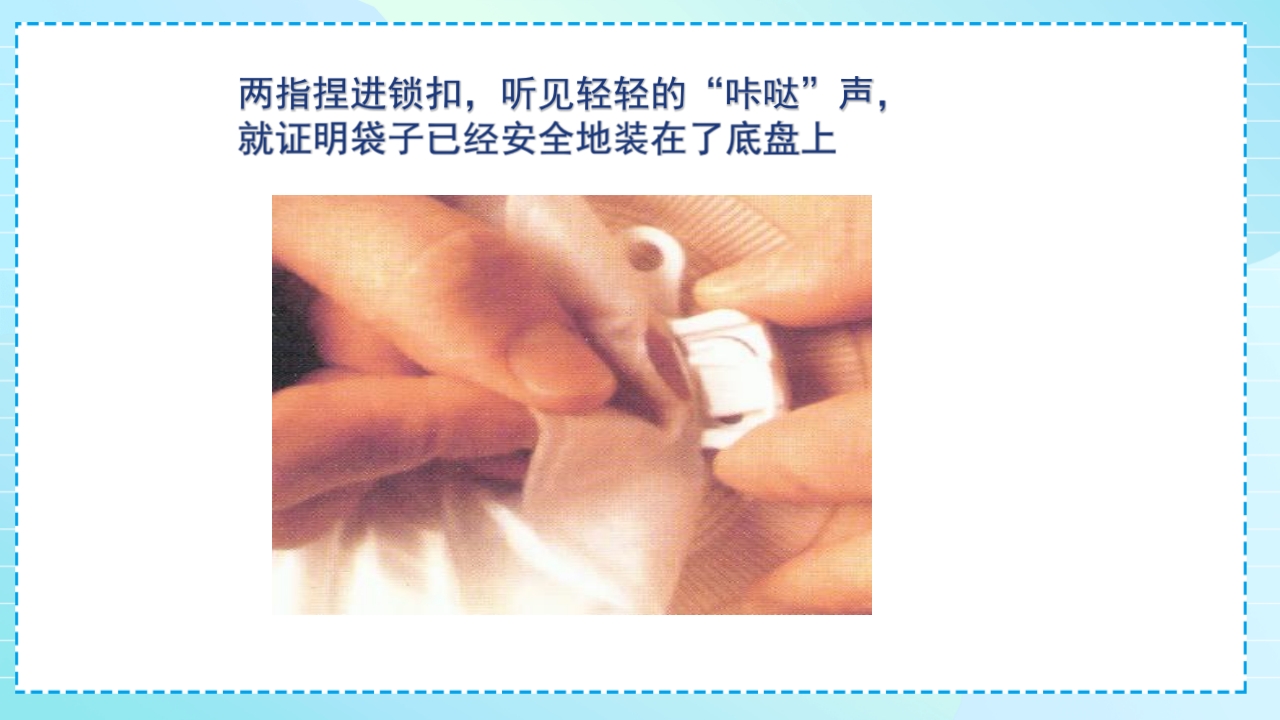 肠造口护理PPT课件20