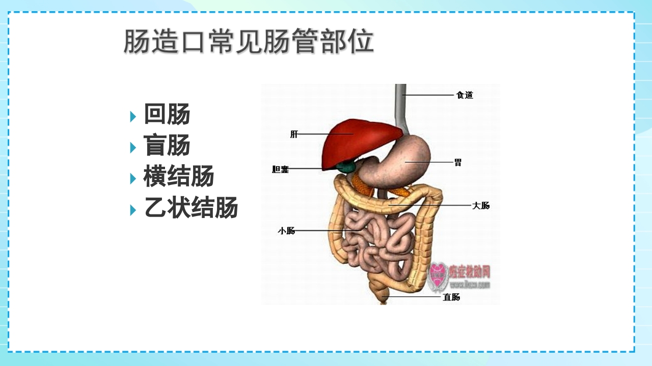 肠造口护理PPT课件5