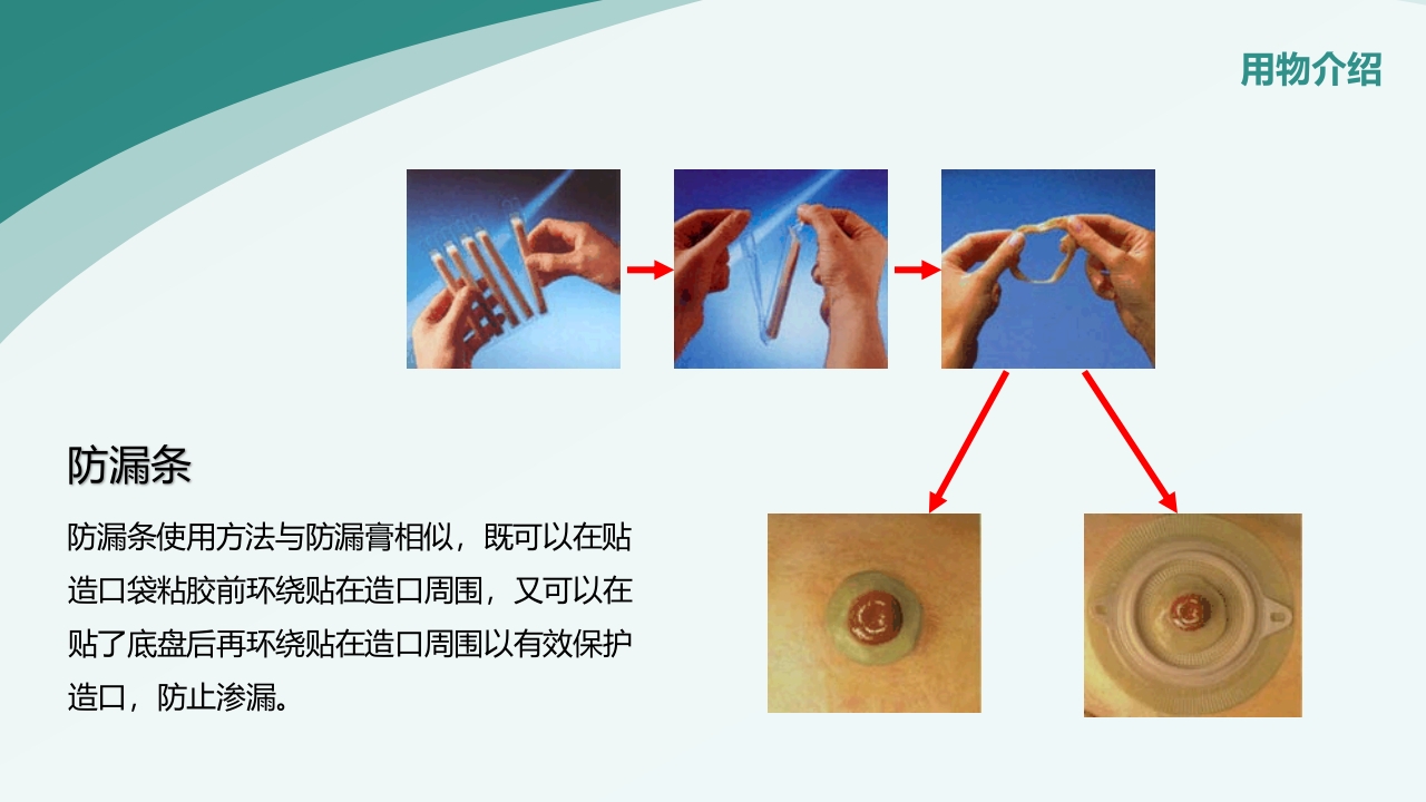 直肠造瘘术后护理PPT课件下载22