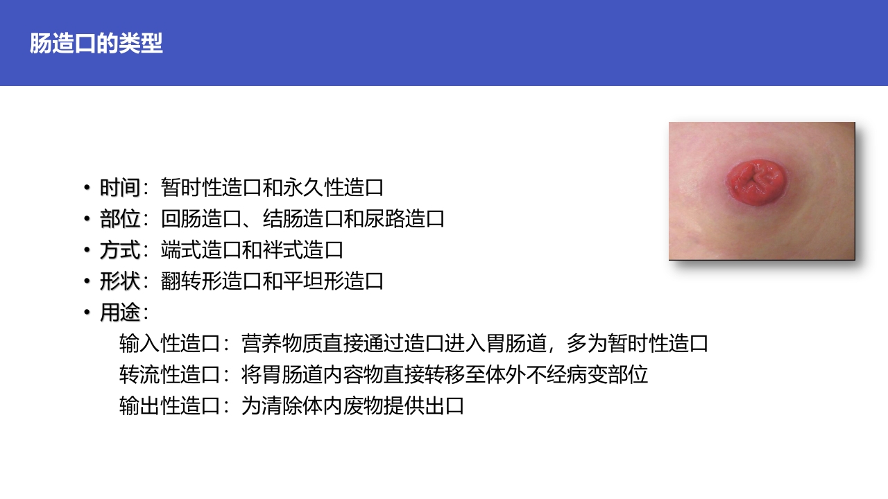直肠造瘘术后护理PPT课件下载5