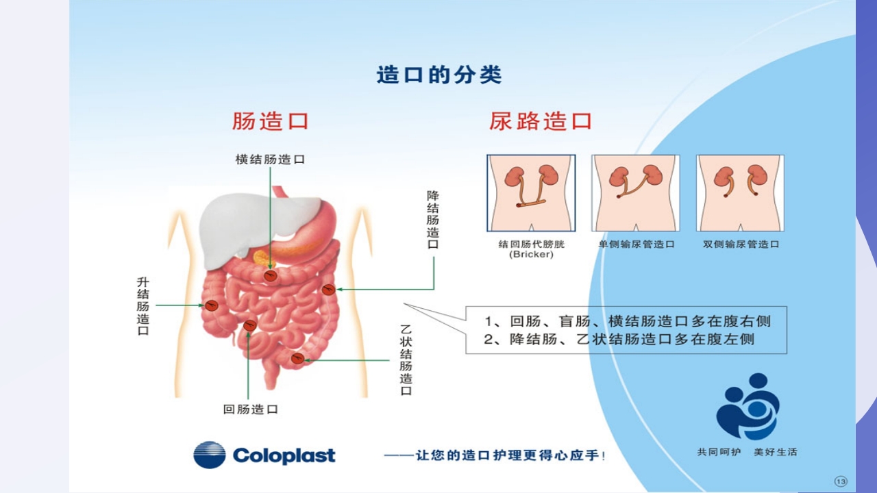 直肠造瘘术后护理PPT课件下载7