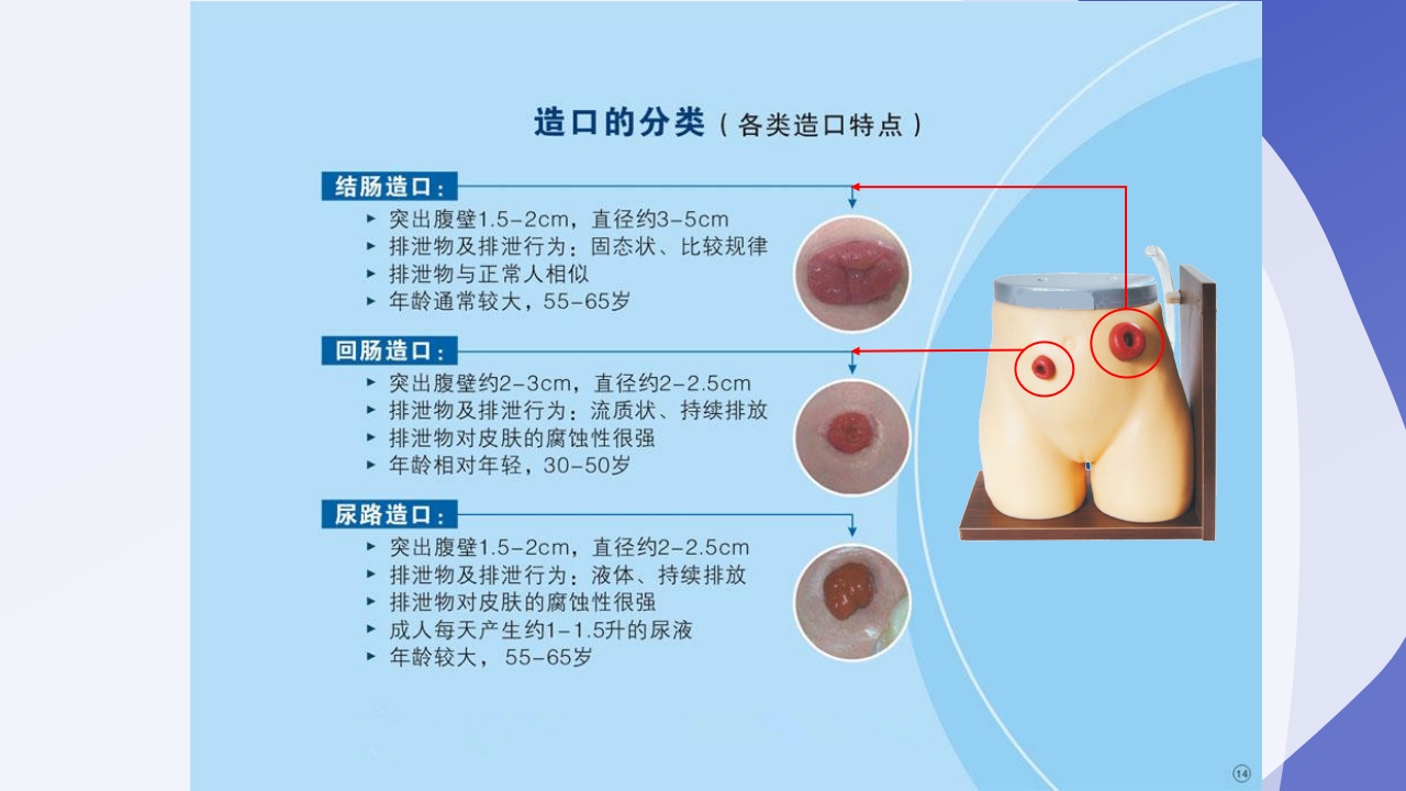 直肠造瘘术后护理PPT课件下载8