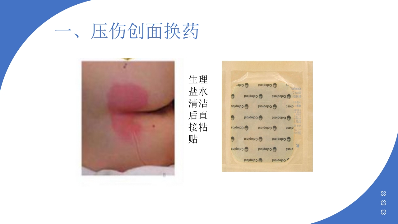 伤口造口换药PPT课件16