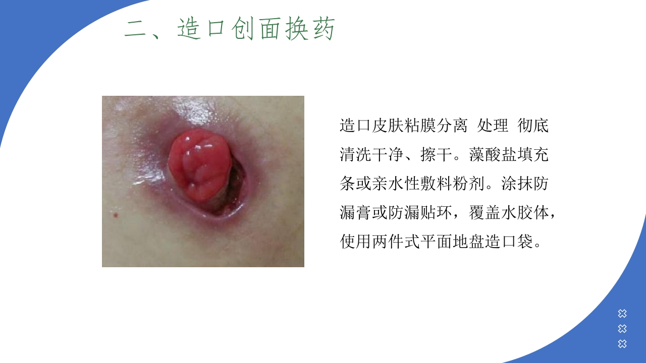伤口造口换药PPT课件26