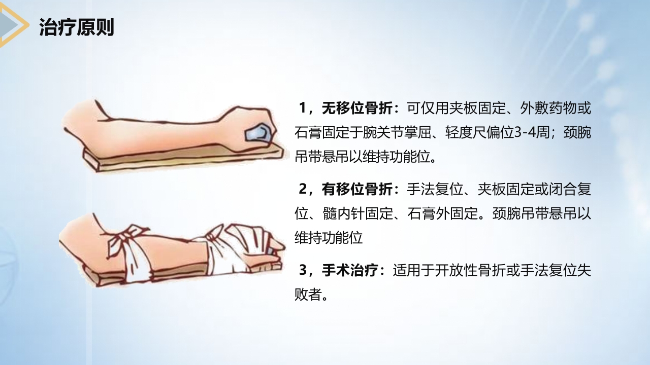 左桡尺骨双骨折的护理查房PPT课件13