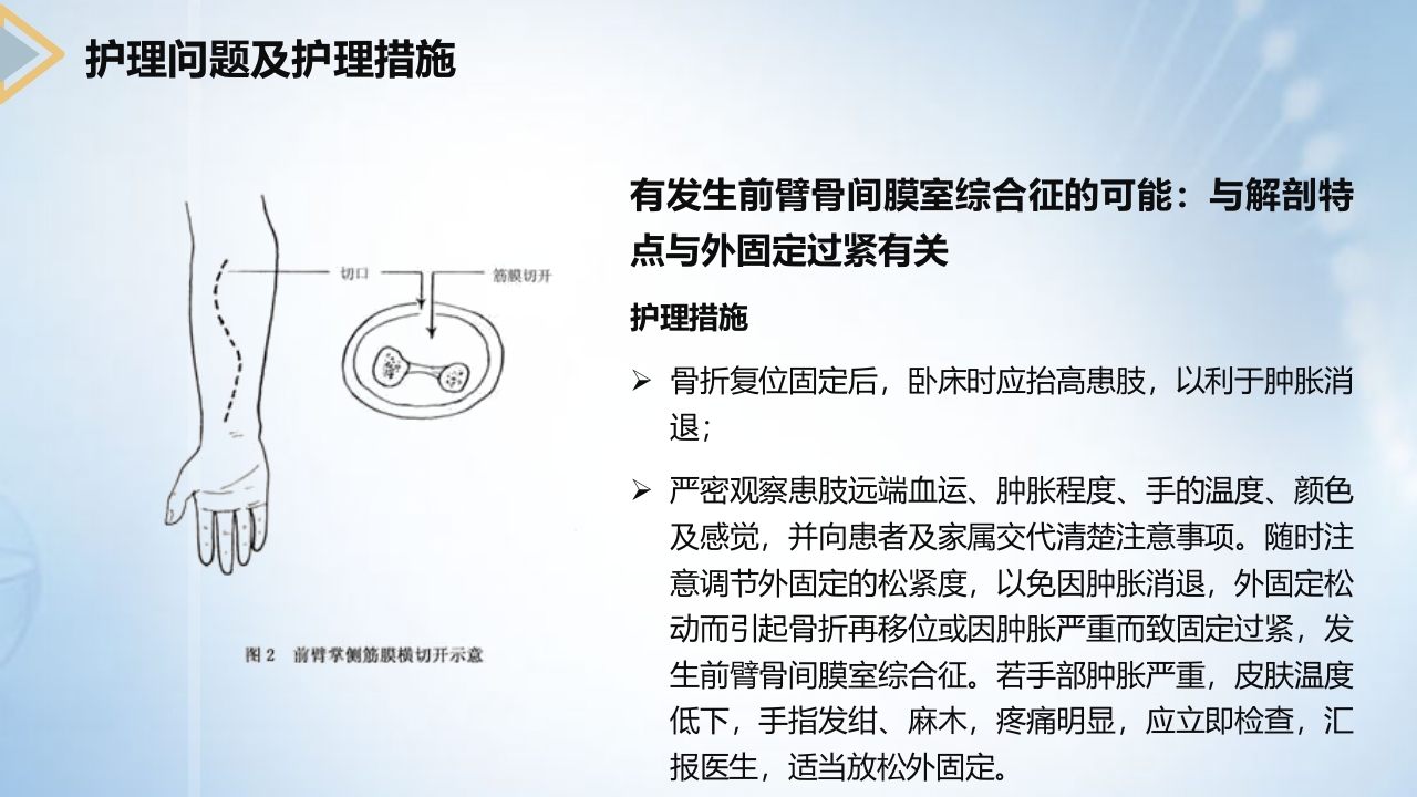 左桡尺骨双骨折的护理查房PPT课件17