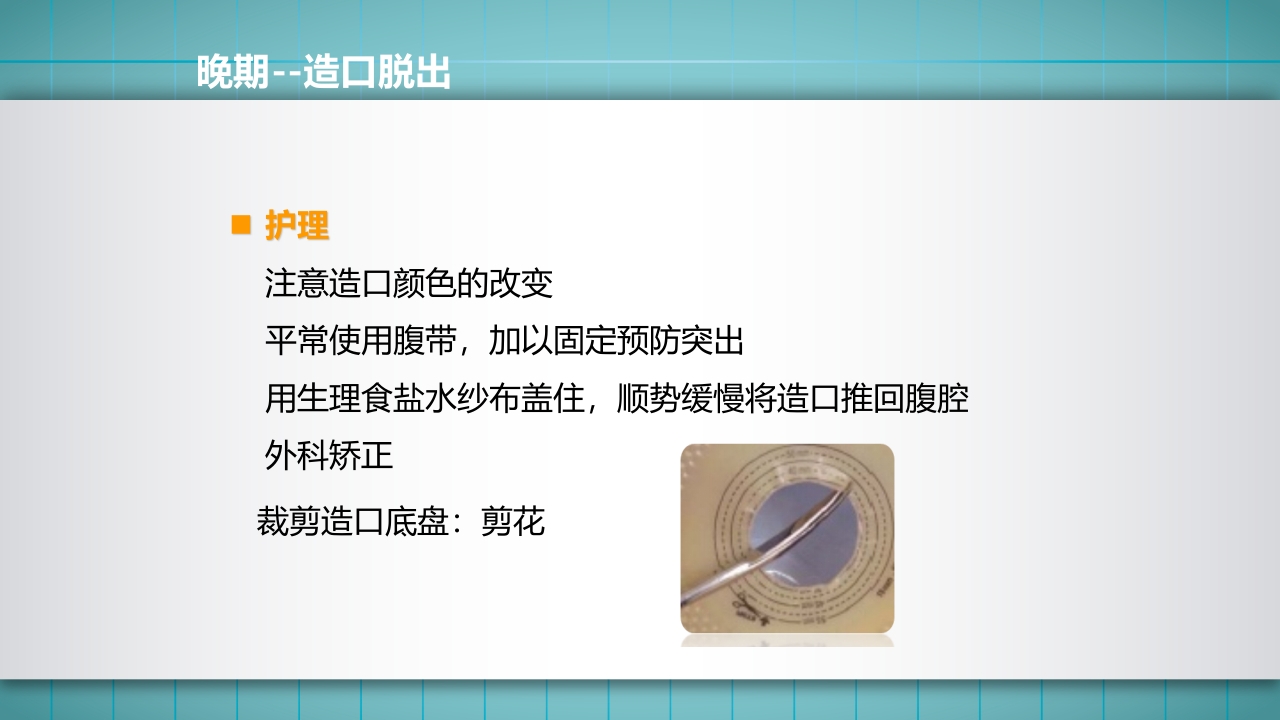 小儿肠造口护理PPT课件下载32