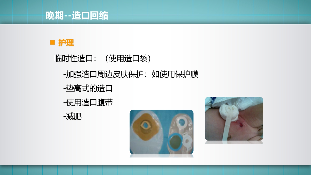 小儿肠造口护理PPT课件下载34