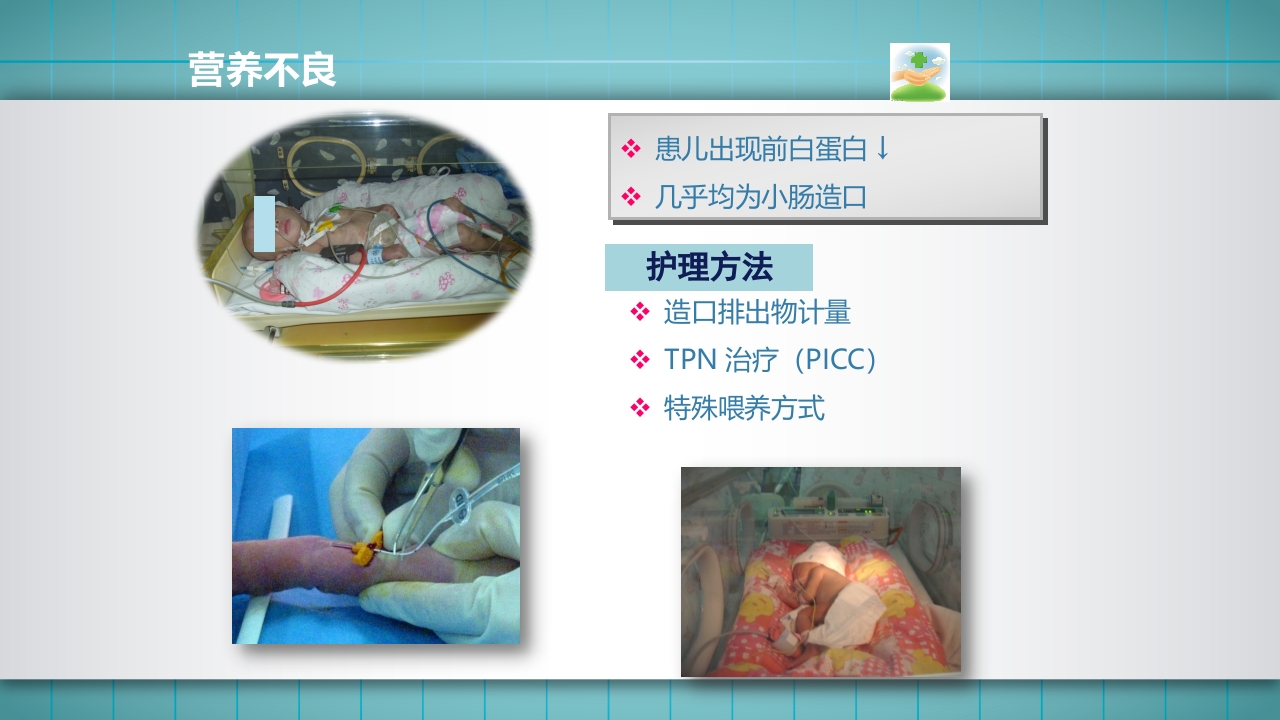小儿肠造口护理PPT课件下载41