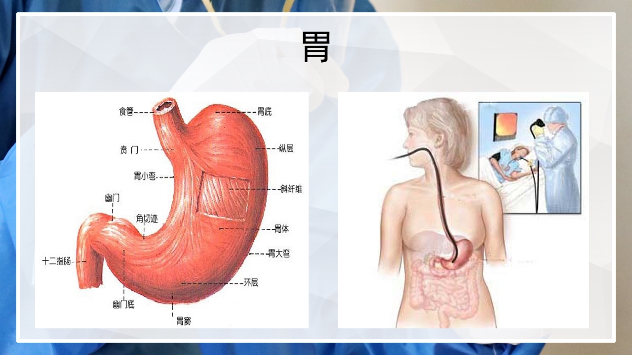 内镜下胃肠息肉切除术的护理PPT课件3