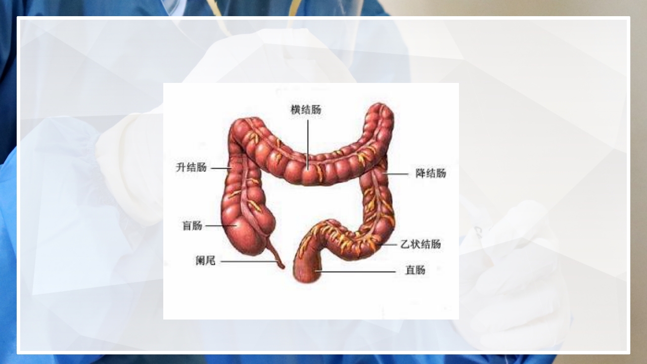 内镜下胃肠息肉切除术的护理PPT课件7