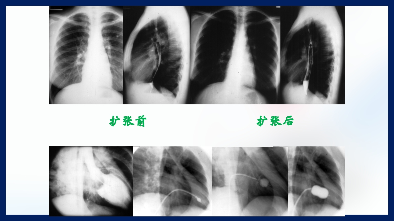 心脏瓣膜病PPT课件下载35