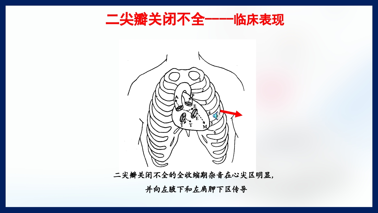 心脏瓣膜病PPT课件下载44
