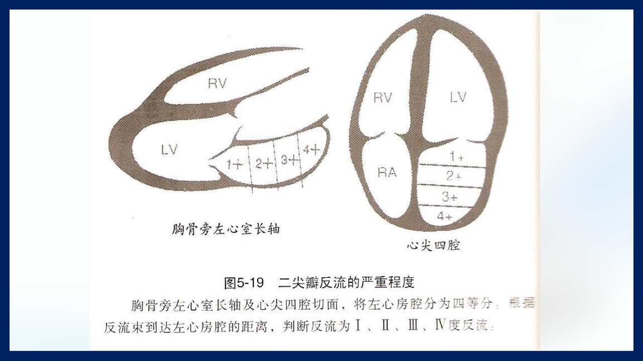 心脏瓣膜病PPT课件下载51