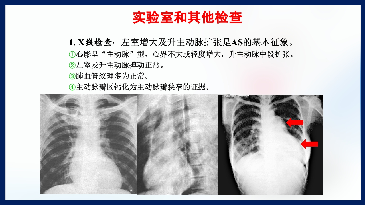 心脏瓣膜病PPT课件下载68