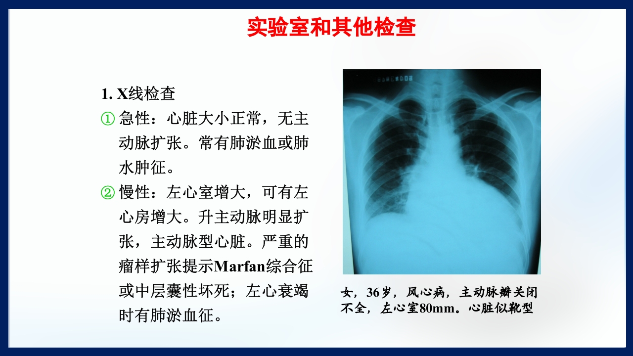 心脏瓣膜病PPT课件下载87