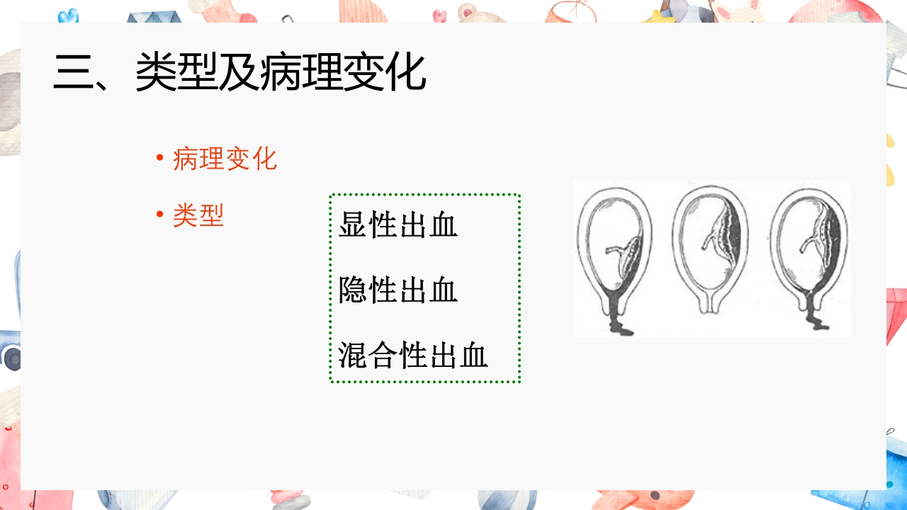 胎盘早剥护理PPT课件9