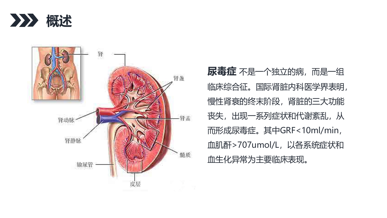 尿毒症的护理查房PPT课件21