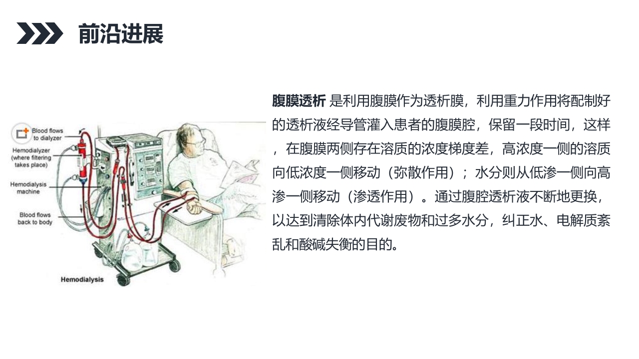 尿毒症的护理查房PPT课件37