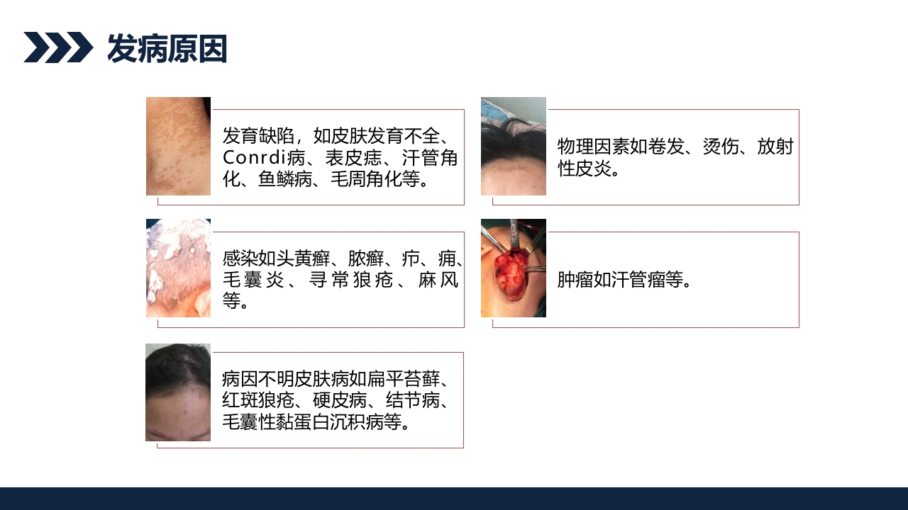 瘢痕性脱发患者护理查房PPT课件5