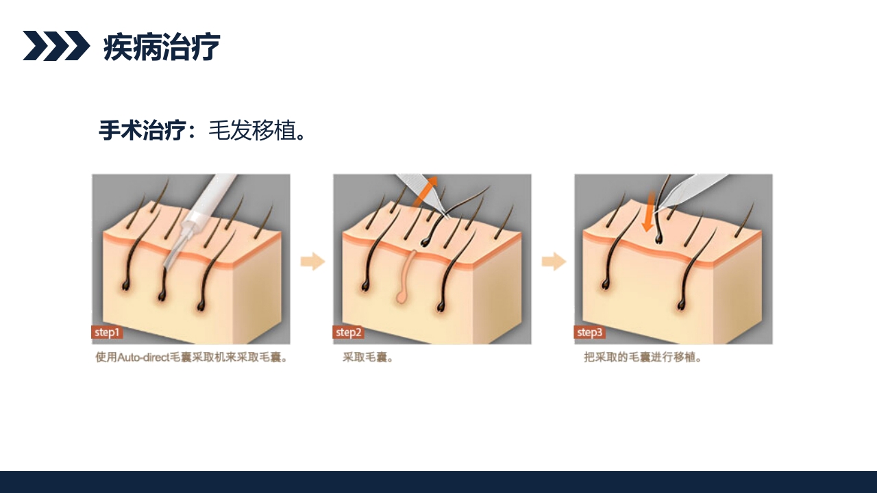 瘢痕性脱发患者护理查房PPT课件9