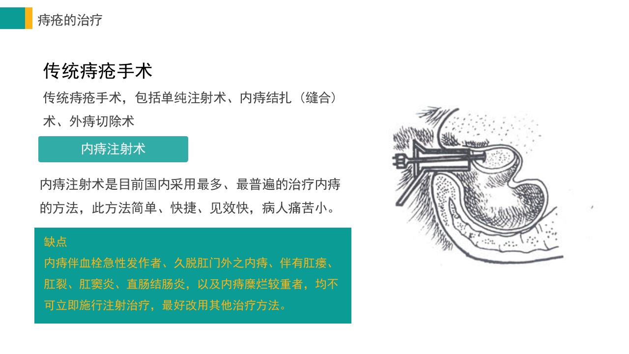 痔疮病护理培训PPT课件17