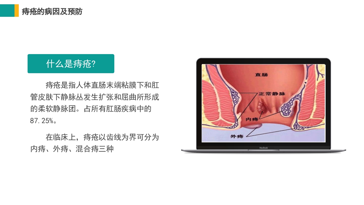 痔疮病护理培训PPT课件5