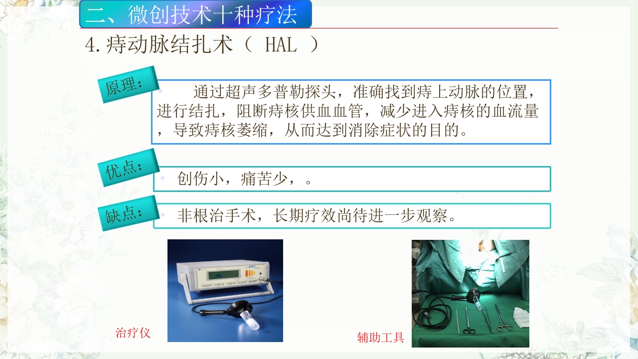 痔疮的微创手术PPT课件14