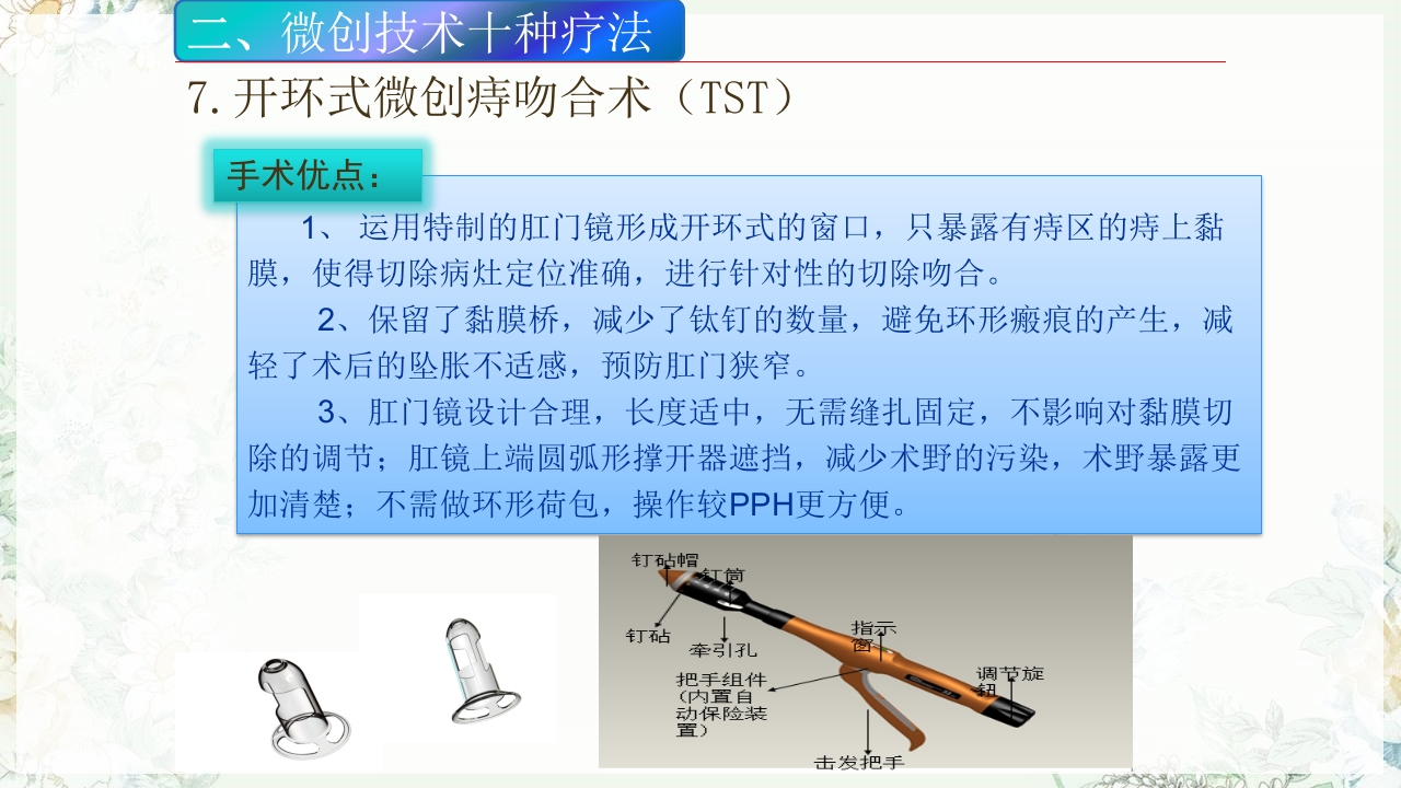 痔疮的微创手术PPT课件23