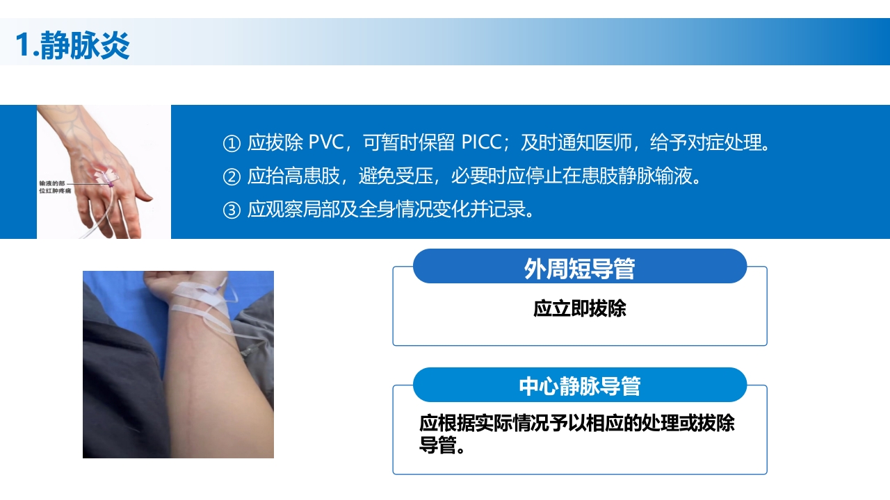 (2023版)静脉治疗护理技术操作标准PPT课件39