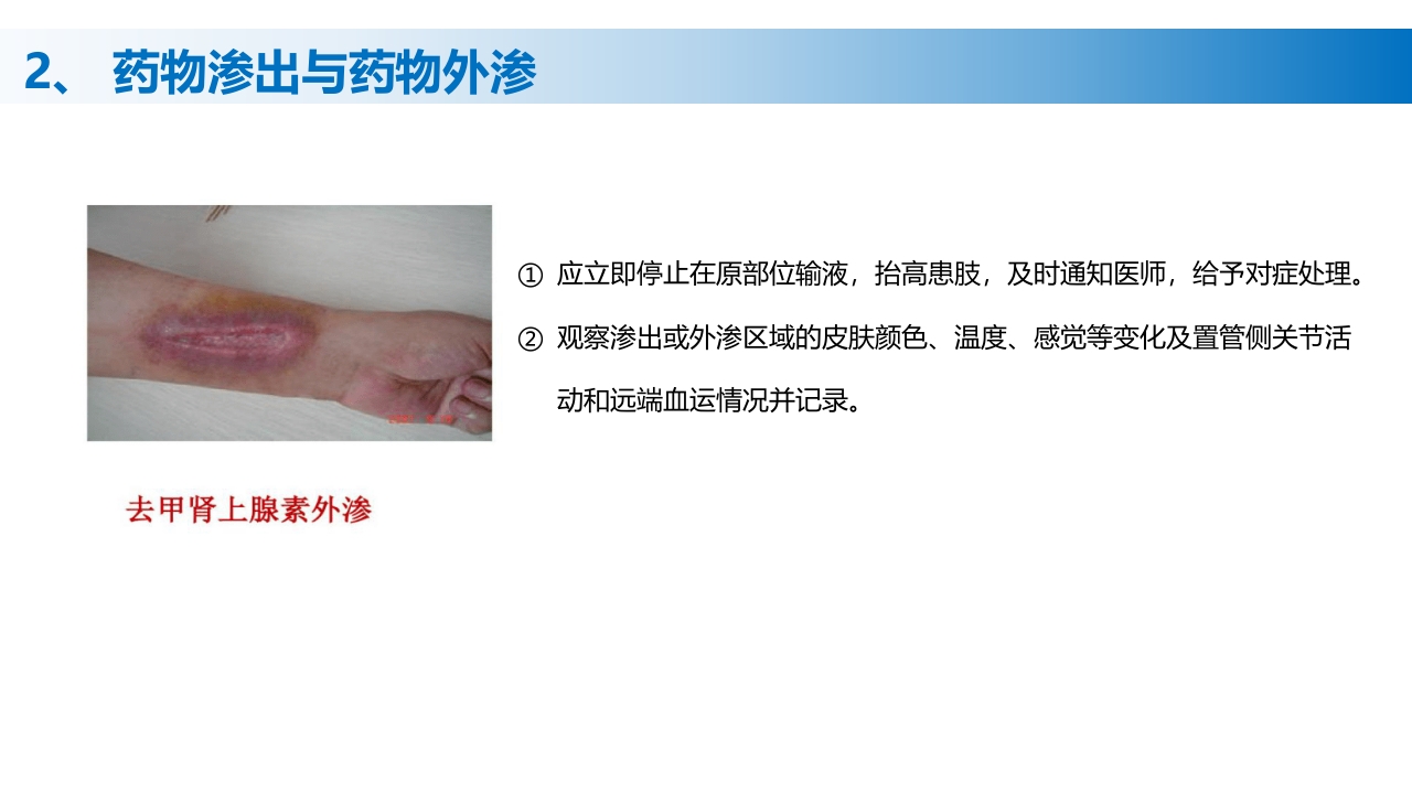 (2023版)静脉治疗护理技术操作标准PPT课件40