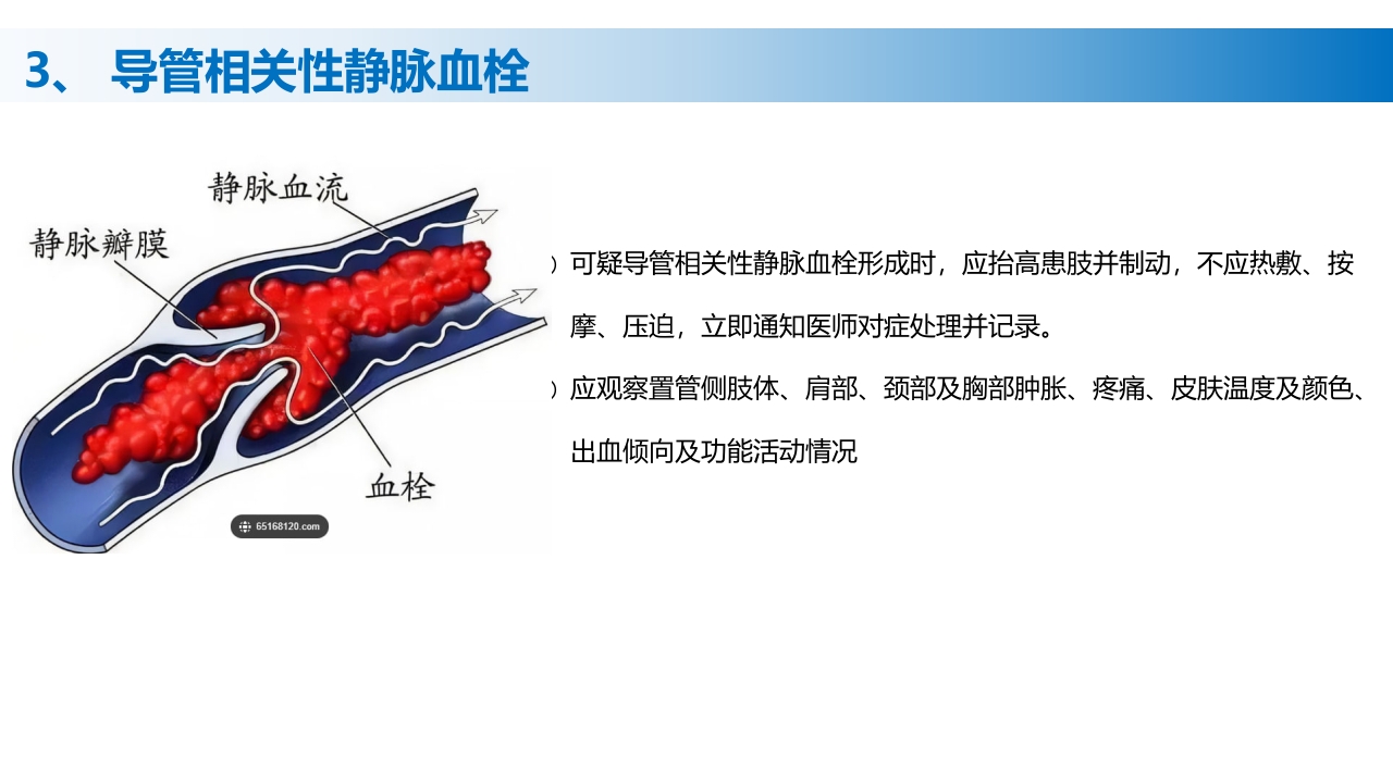 (2023版)静脉治疗护理技术操作标准PPT课件41