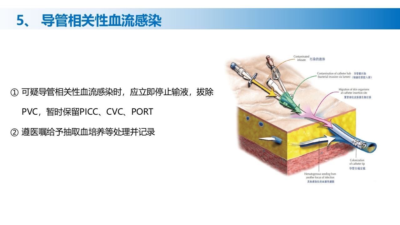 (2023版)静脉治疗护理技术操作标准PPT课件43