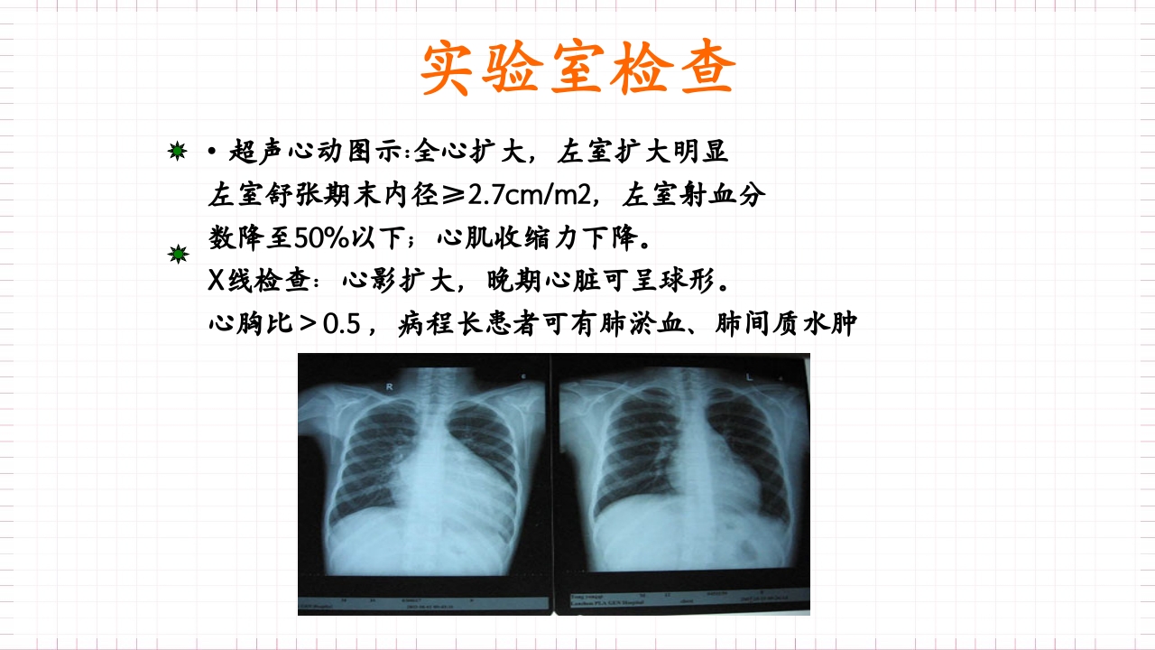 扩张型心肌病的护理PPT课件下载12