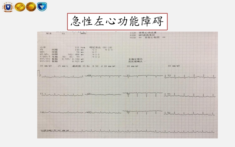 脓毒性心肌病PPT课件下载10