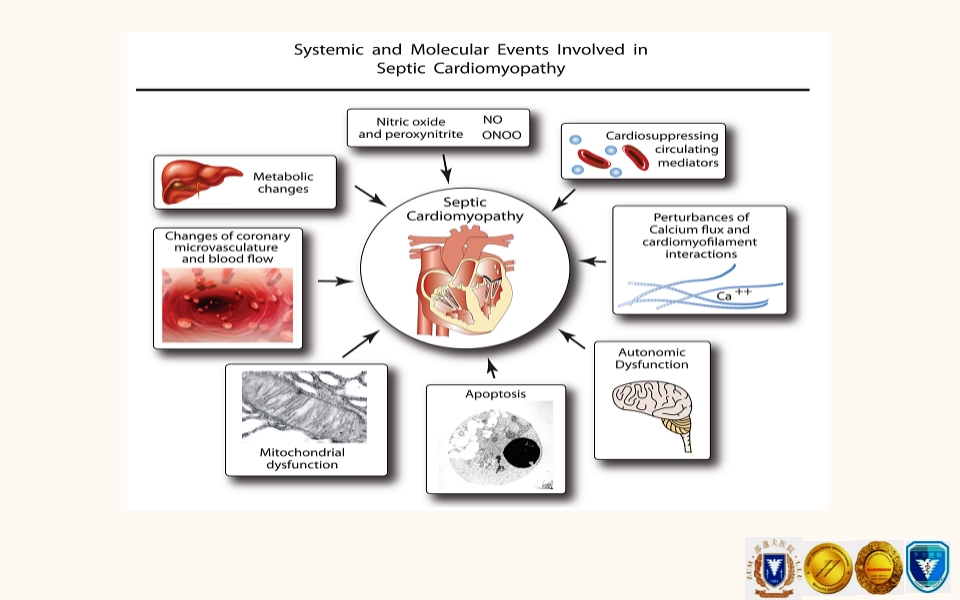 脓毒性心肌病PPT课件下载20