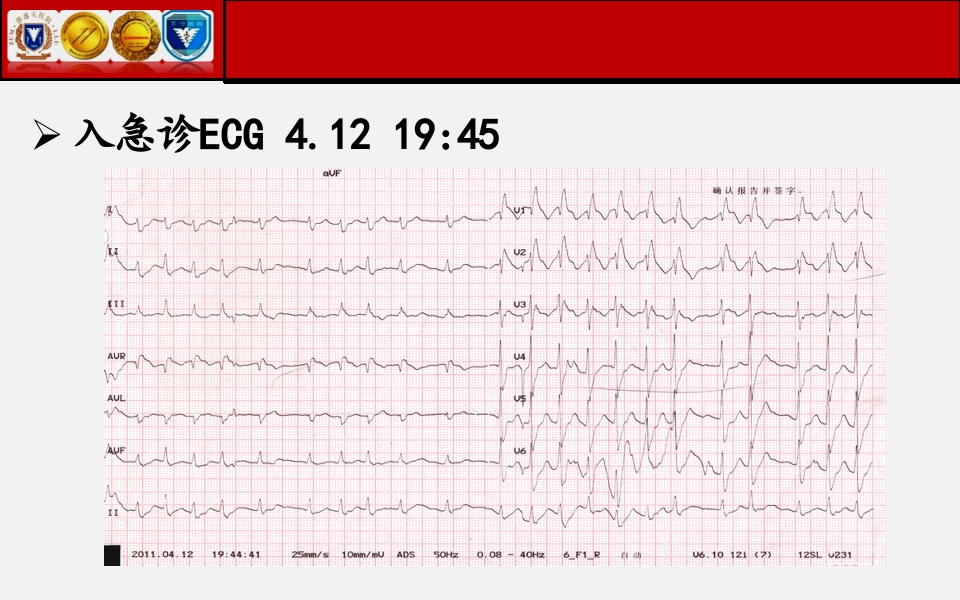 脓毒性心肌病PPT课件下载27